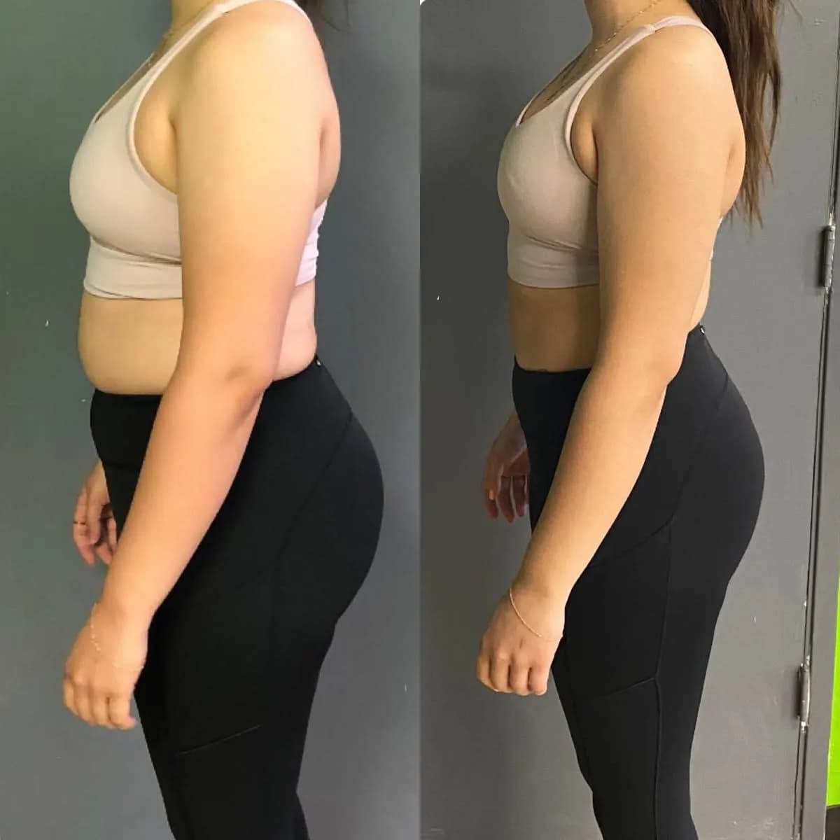 Toned Body After Body Sculpting